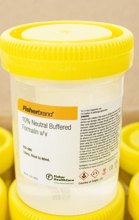 Fisherbrand 10% Buffered Formalin Container 120mL Leakproof Graduated